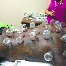 拔罐吃瓜,夏日养生新风尚